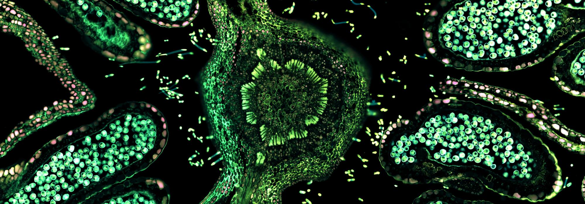 Hazelnut (male flower), overlay of 7 channel autofluorescence microscopy - Image: © ZEISS Microscopy (CC-BY 2.0) Hazelnut (male flower), overlay of 7 channel autofluorescence microscopy - Image: © ZEISS Microscopy (CC-BY 2.0)