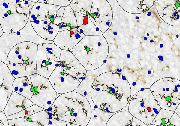 Microglial analysis software. Nuclei are highlighted in blue. Microglia that are activated are highlighted in red, whilst inactivated ones are in green. The black borders represent the borders of the microglial cells’ sphere of influence, which is here defined by where the processes (in yellow) of that microglial cell are extending.