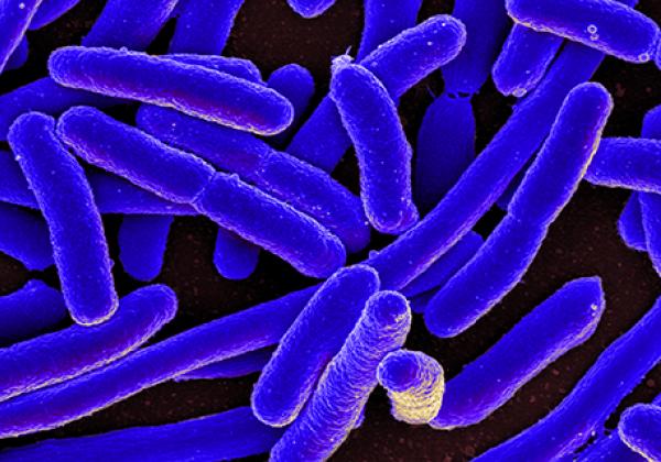 Colourised scanning electron micrograph of E. coli.