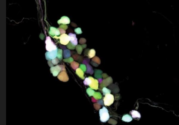 Confocal image of intrinsic neurons in mouse heart labelled with a multicolour adeno-associated viral technique. Reproduced with permission of Wiley-VCH