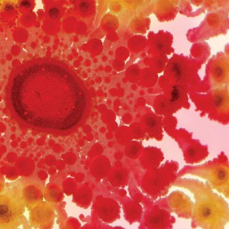 Dyed Paenibacillus colony showing its pattern of growth - Image: © Soonhee Moon/Tal Danino Dyed Paenibacillus colony showing its pattern of growth - Image: © Soonhee Moon/Tal Danino
