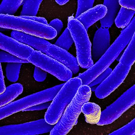 Colourised scanning electron micrograph of E. coli.