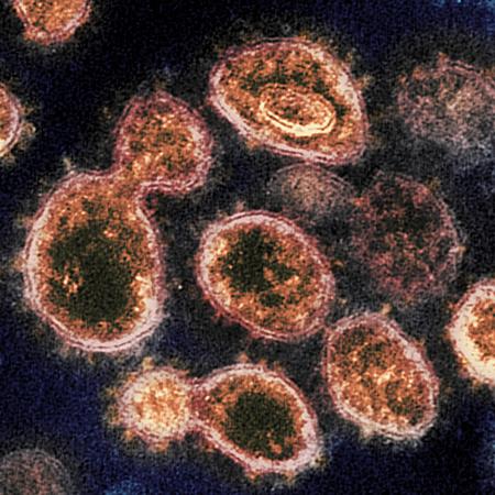 A transmission electron microscope image showing SARS-CoV-2, the virus that causes COVID-19 - image: US National Institutes of Health