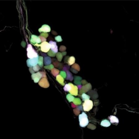 Confocal image of intrinsic neurons in mouse heart labelled with a multicolour adeno-associated viral technique. Reproduced with permission of Wiley-VCH